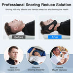 Anti-Snoring Chin Strap | Breathable Double-Layer & Adjustable Velcro | For Sleep Apnea