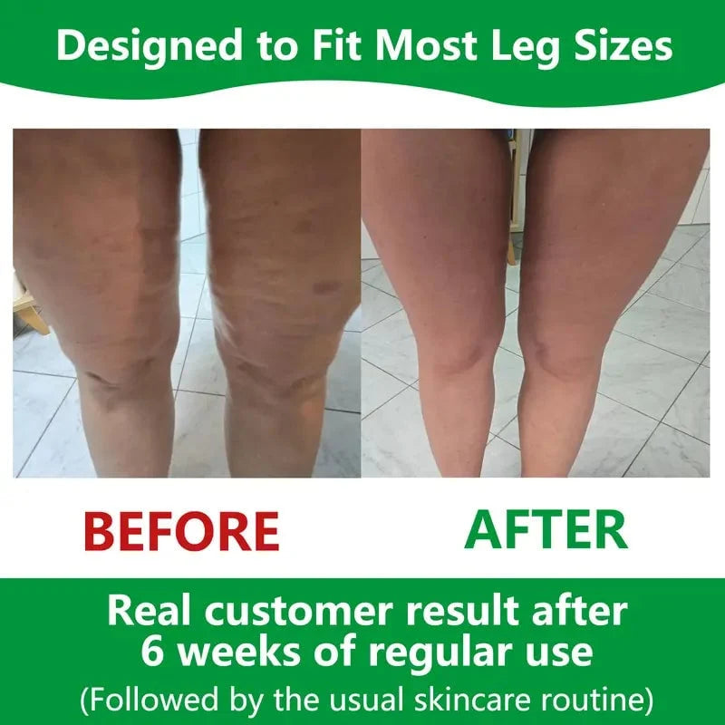 Cellulite Massage Roller | 360° Deep-Tissue Rollers & Adjustable Fit