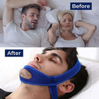 Chin Strap | Adjustable Breathable Neoprene Full-Head Support
